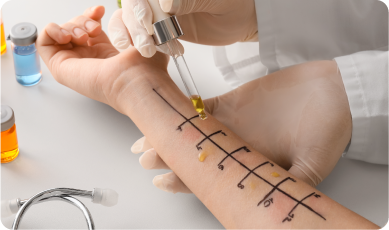 Allergy testing to check for the correct treatment