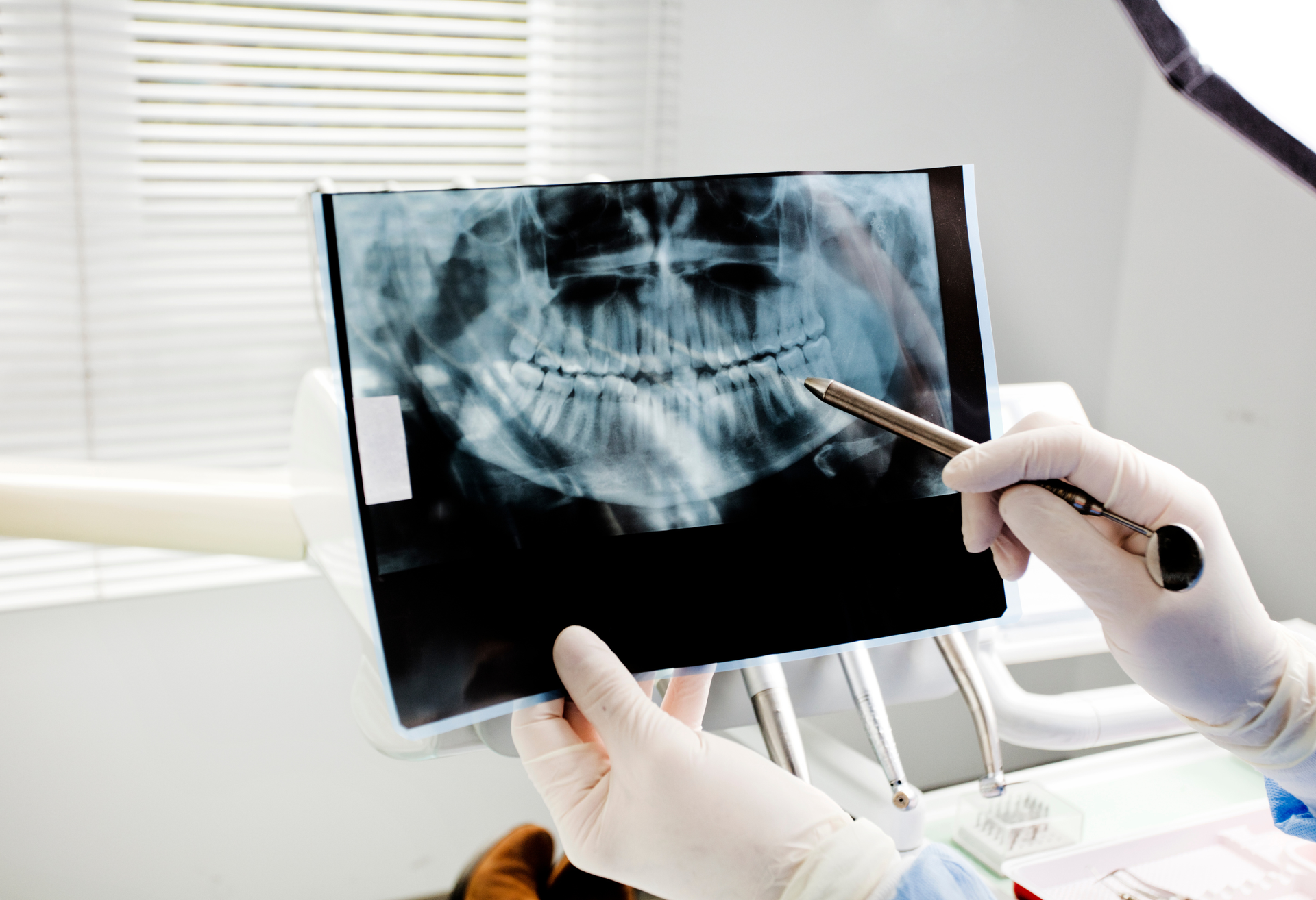 Dental exam and X-rays at Smile Forever Atlanta