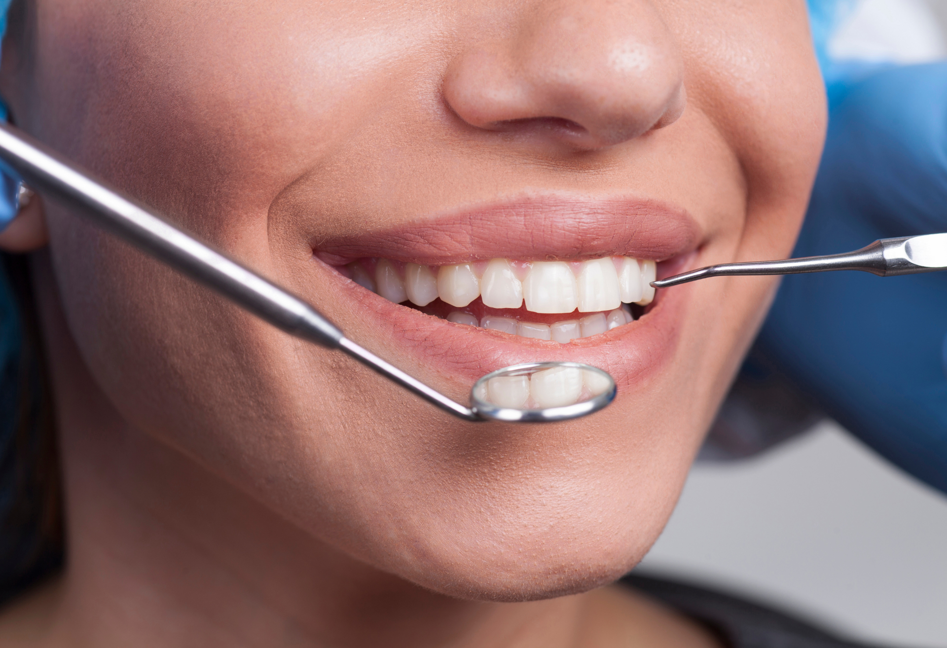 Close-up of a smiling mouth during a dental exam, with dental tools examining teeth