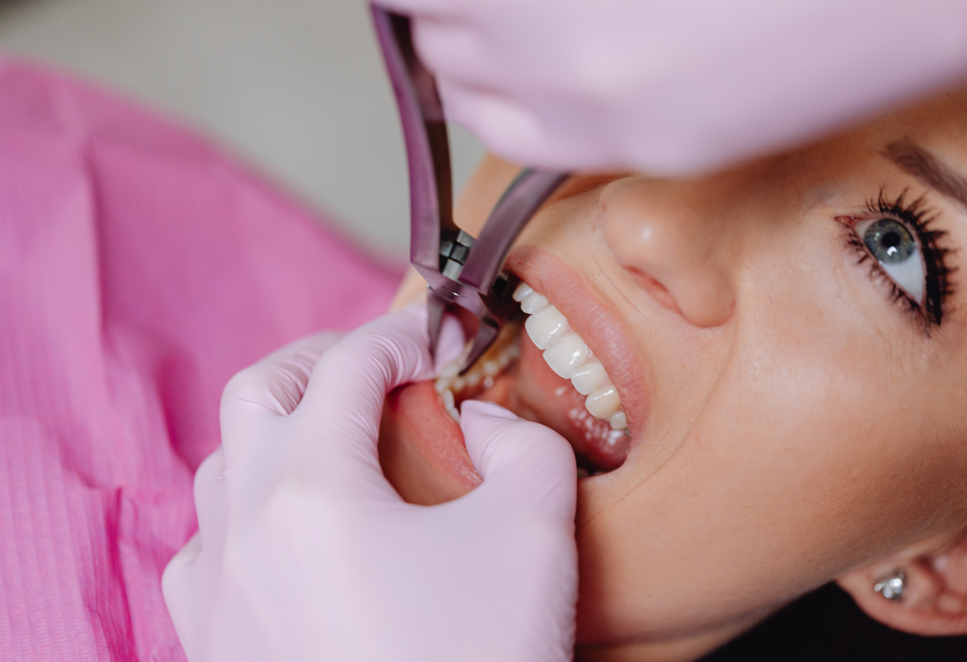 Patient receiving dental care at Smile Forever Atlanta
