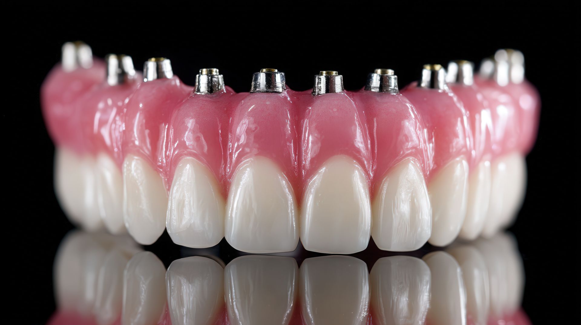 Implant Dentures