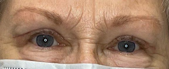 Close-up of a person's blue eyes above a white face mask