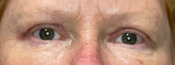 Close-up of a person's eyes and upper face with light skin and reddish eyebrows, looking at the camera
