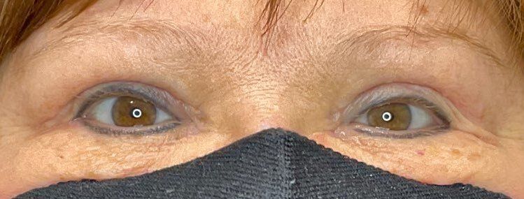 Close-up of a person's eyes above a black face mask