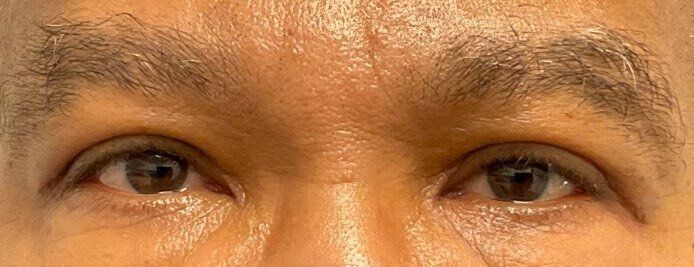 Close-up of a person’s eyes and brows with a neutral expression.