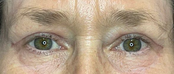 Close-up of a person’s eyes and upper face with green irises and a neutral expression