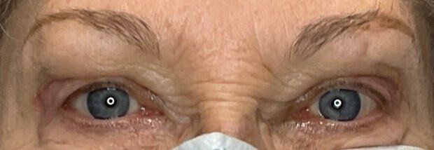 Close-up of two blue eyes looking forward, with a white face mask covering the nose and mouth