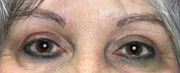 Close-up of a person’s eyes with dark makeup and visibly red, irritated lower eyelids