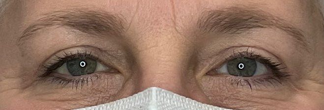Close-up of a person’s eyes above a white face mask