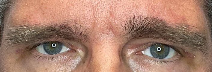 Close-up of a person’s blue eyes and furrowed brows, showing a focused expression