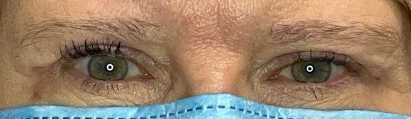 Close-up of a person's eyes above a blue surgical mask