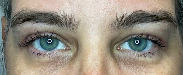Close-up of a person's blue eyes and eyebrows, looking straight ahead.