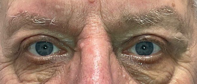 Close-up of a person's blue eyes and brow with a neutral expression