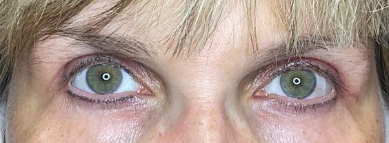Close-up of green eyes with dark under-eye shadows and blonde bangs across the forehead
