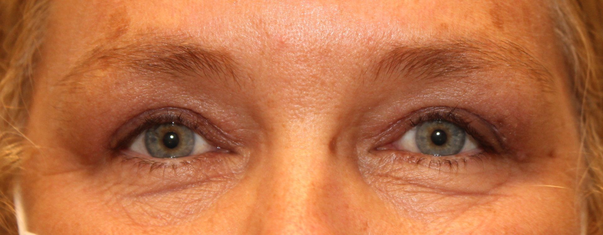 Close-up of a person's eyes and eyebrows, looking at the camera.