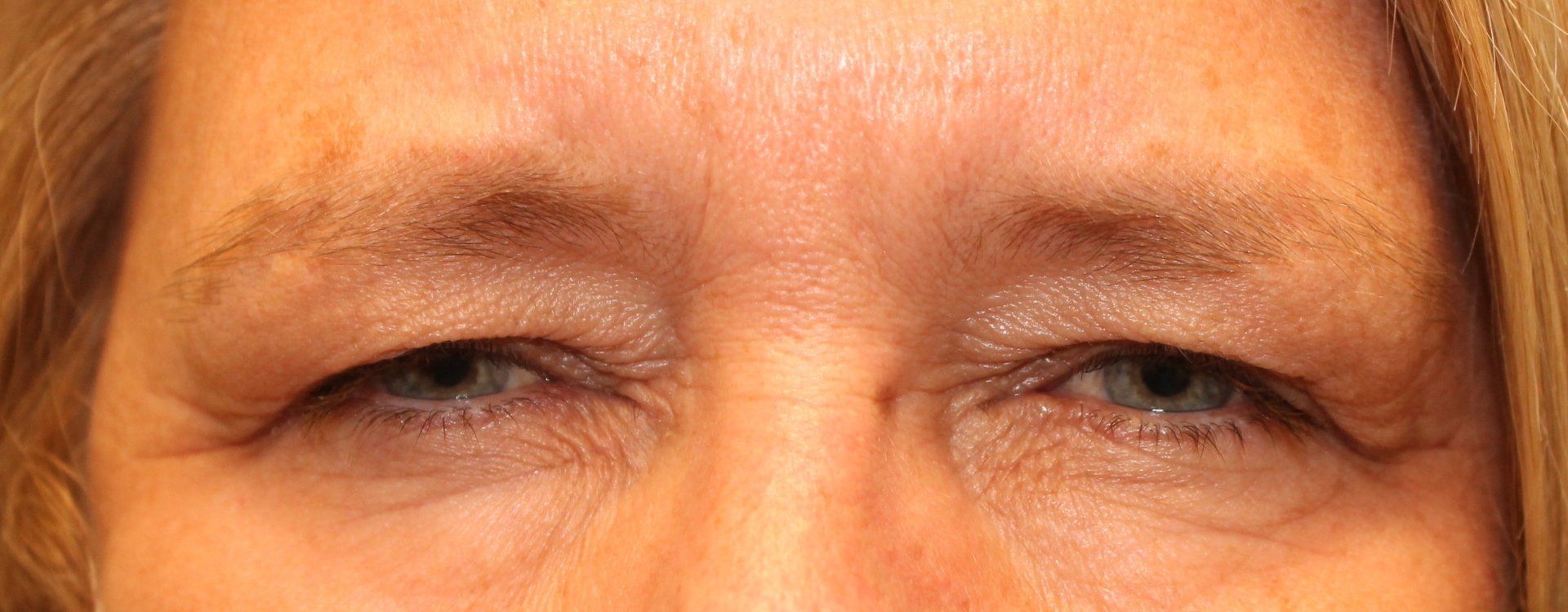 Close-up of a person’s eyes and forehead with a slight squint against warm orange light