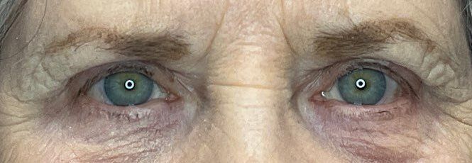 Close-up of blue-green eyes with wrinkles and dark circles around them