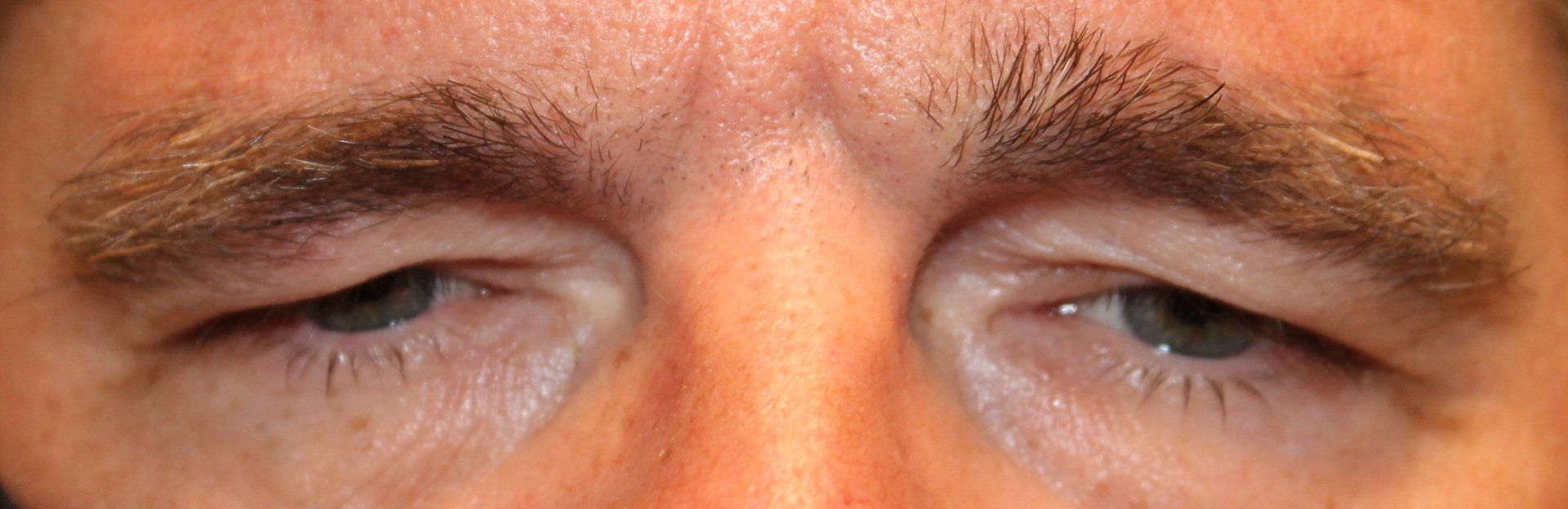 Close-up of a person’s eyes and eyebrows, slightly squinting.