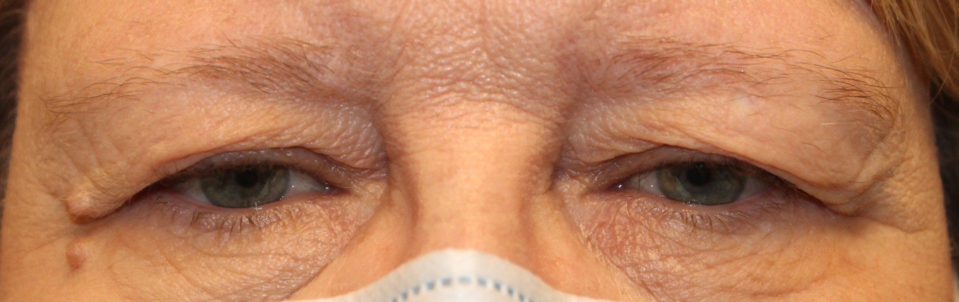 Close-up of a person’s eyes above a white face mask, looking forward
