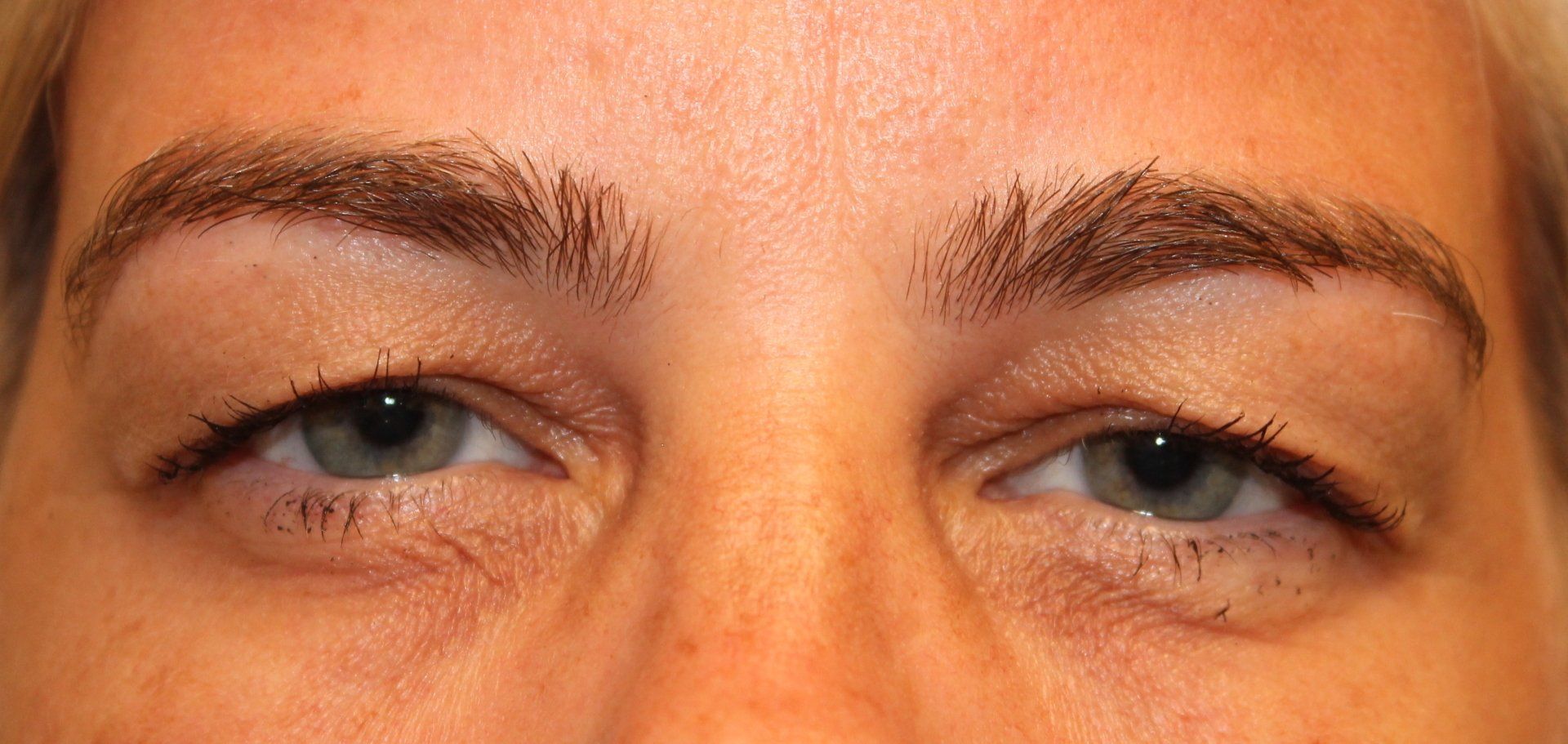 Close-up of a person’s eyes with blue irises and light eyebrows, looking forward