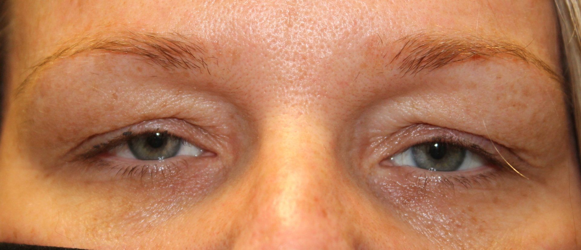 Close-up of a person's eyes and eyebrows with a neutral expression.