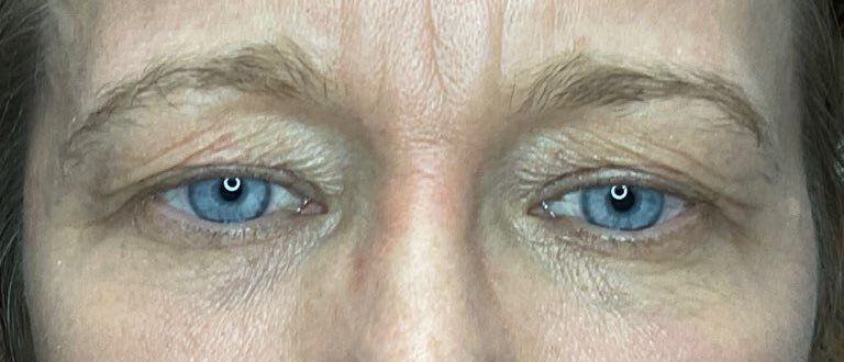 Close-up of a person’s blue eyes and brow with a neutral expression
