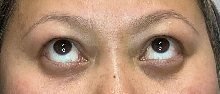 Close-up of eyes looking upward, showing the upper face against a plain background