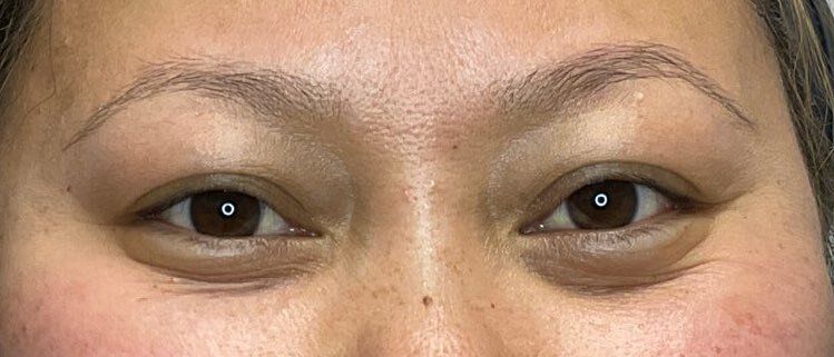 Close-up of a person’s eyes and upper cheeks, with natural makeup and a neutral expression