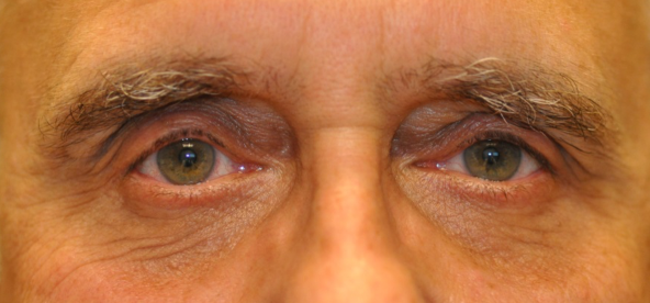 Close-up of a person's eyes and eyebrows, looking forward with a neutral expression