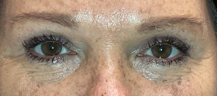 Close-up of eyes with dark makeup, eyebrow pencil marks, and a silver glitter tear under one eye