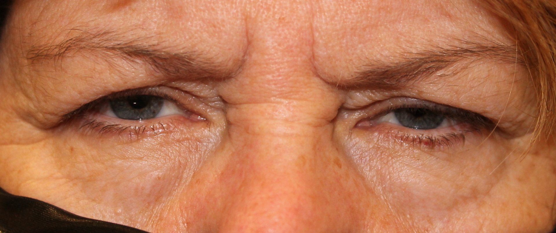 Close-up of wrinkled eyes with a squinting expression