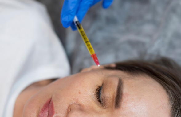 PRP under-eye treatment
