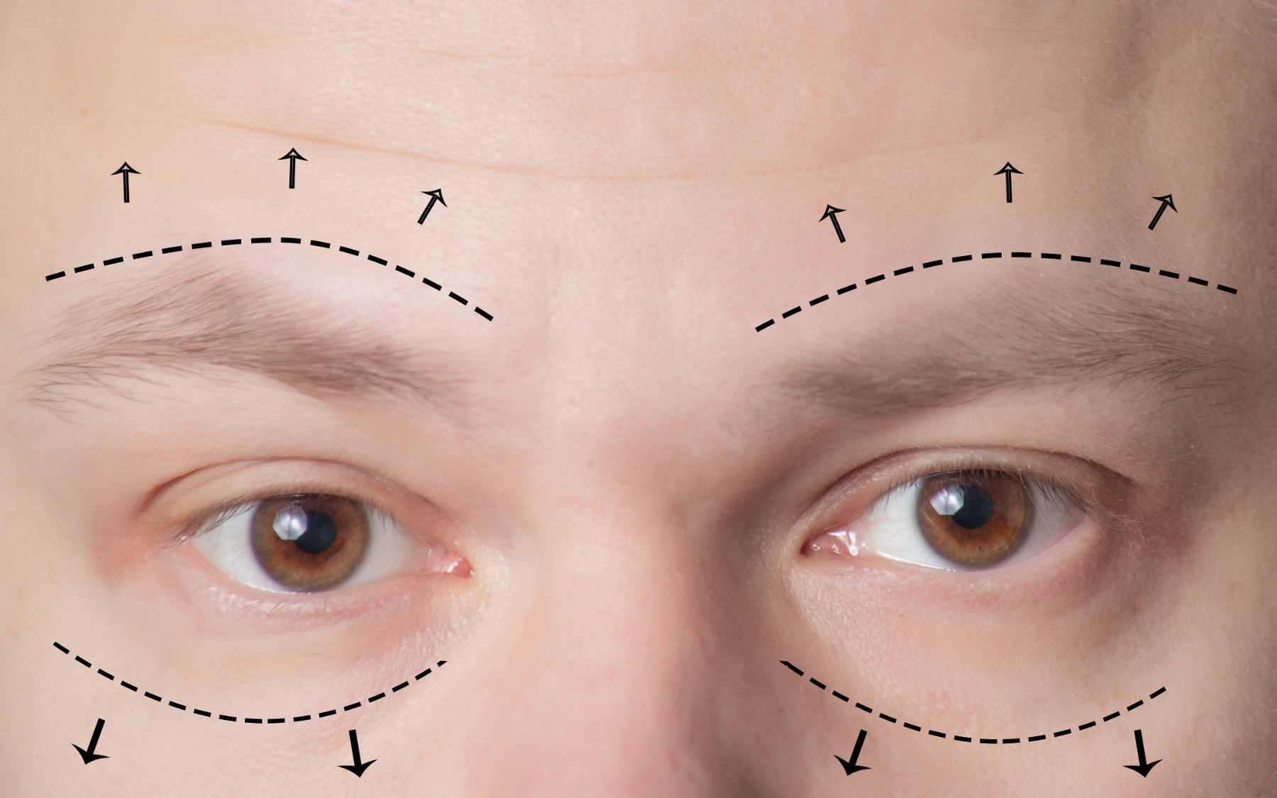 A close up of a man 's eyes with lines drawn on them.