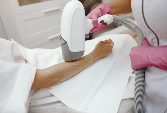 laser hair removal in Clarksville, TN
