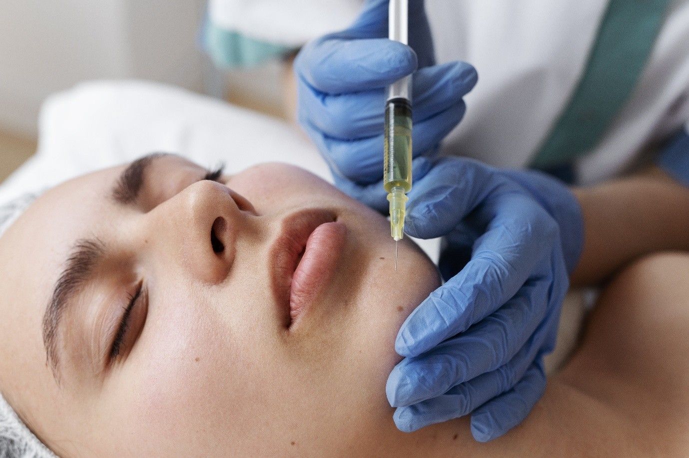 lip fillers in Clarksville