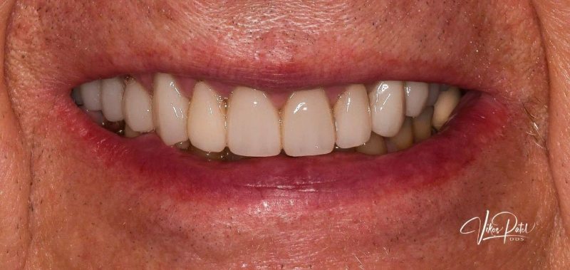 Close-up of a smiling mouth showing white teeth and pink lips