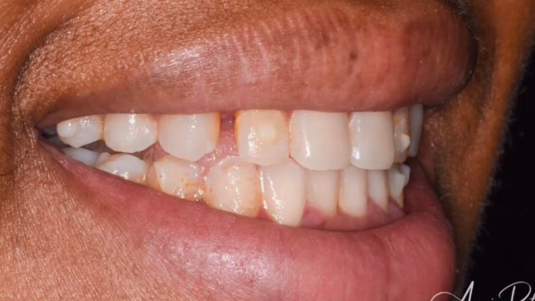 Close-up of a smiling mouth showing white teeth and pink lips