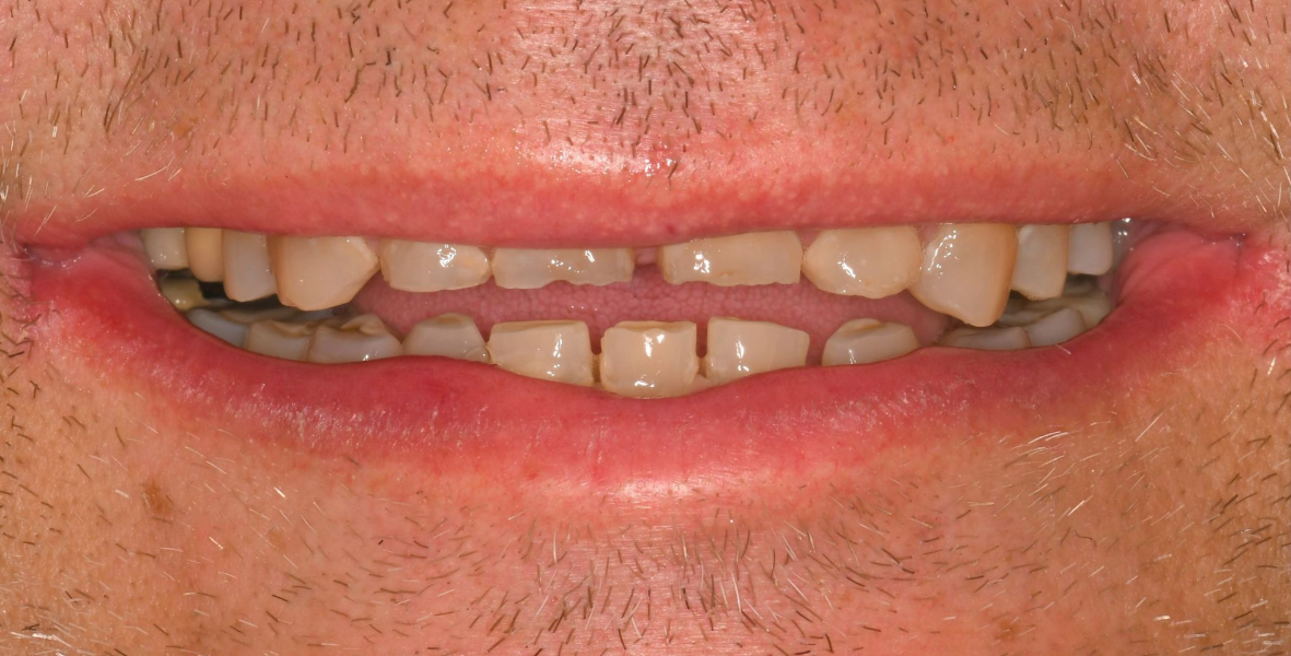 Close-up of a smiling mouth with visible teeth and a gap in the front teeth