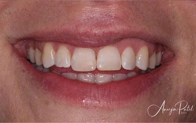 Close-up of a smiling mouth with white teeth and pink lips