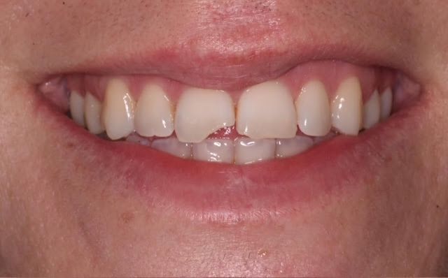 Close-up of a smiling mouth showing teeth and lips