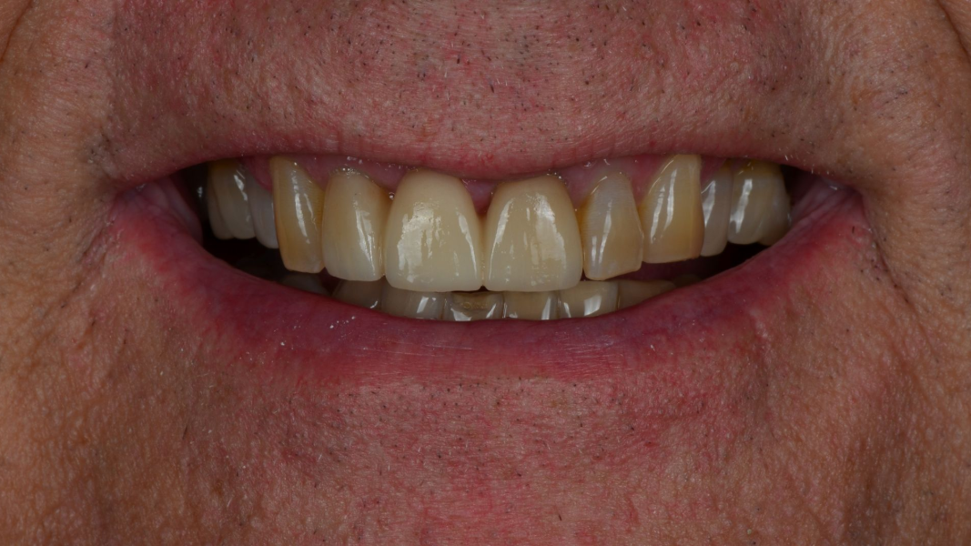 Close-up of a smiling mouth showing white teeth and pink lips.