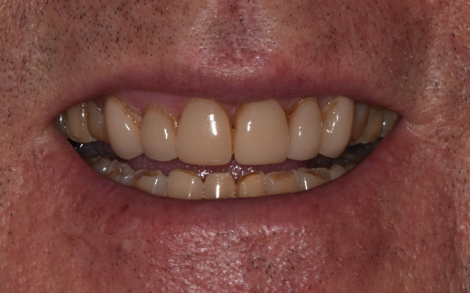 Close-up of a smiling mouth with visible teeth and lips