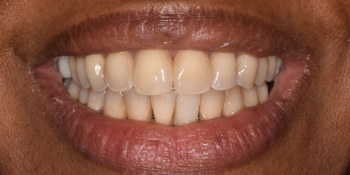 Close-up of a smiling mouth showing white teeth and pink lips