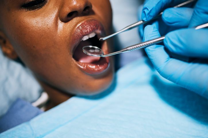 Person in dentist chair, mouth open; dentist examining teeth with tools, wearing blue gloves.