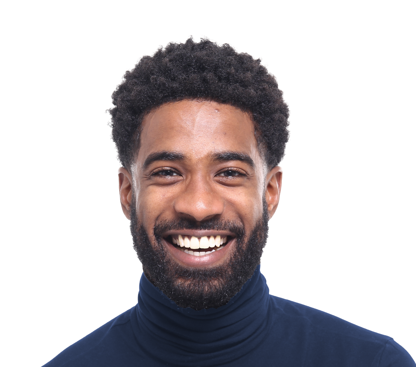 Veneers