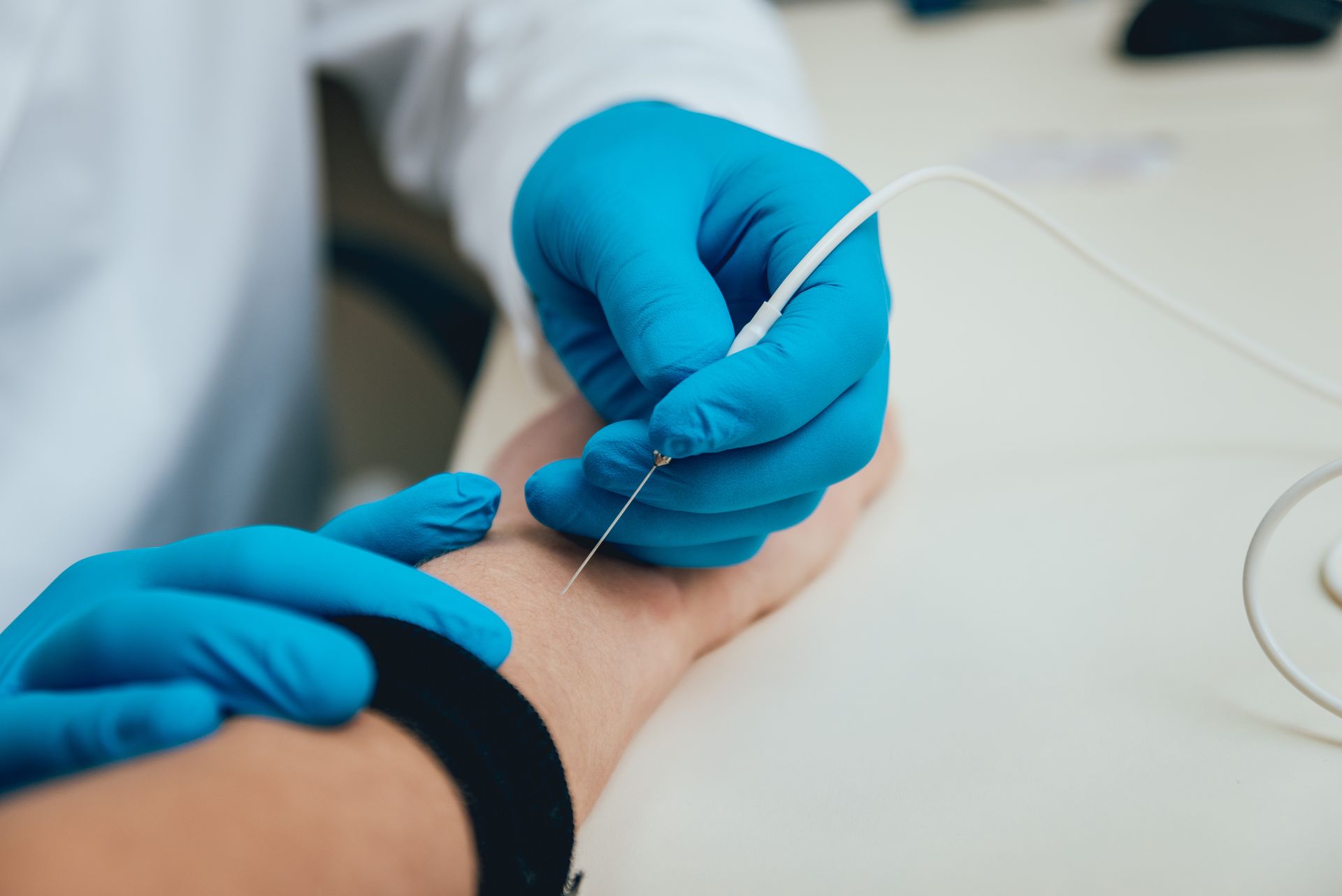 Jitter - Eletroneuromiografia de Fibra Única