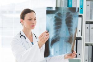Discovering a Car Accident Injury Post-Accident
