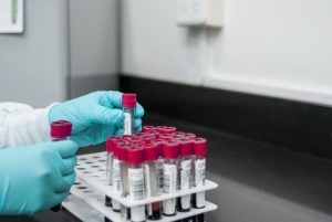 laboratory errors