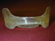 Clear, plastic dental mouthguard on a red surface; curved shape, molded for teeth.