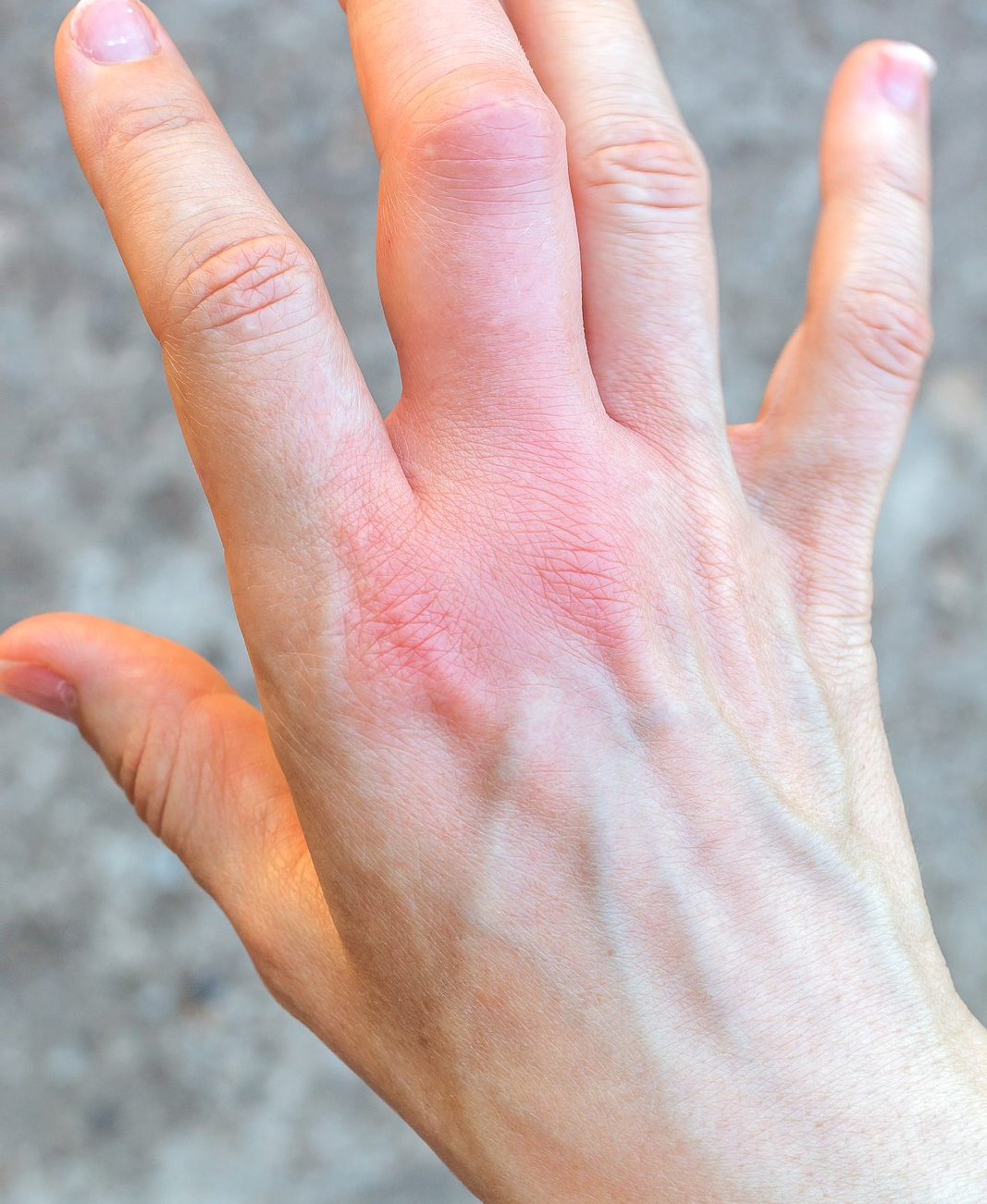 Flea and Tick Removal Near You Flea and Tick Removal Near You
